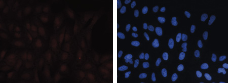 Immunofluorescence figure C