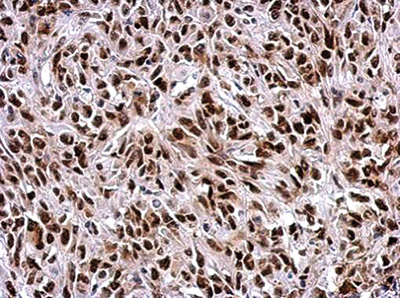 Antibody validated in Immunohistochemical
