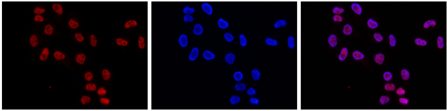 H3K4me2 Antibody validated in Immunofluorescence